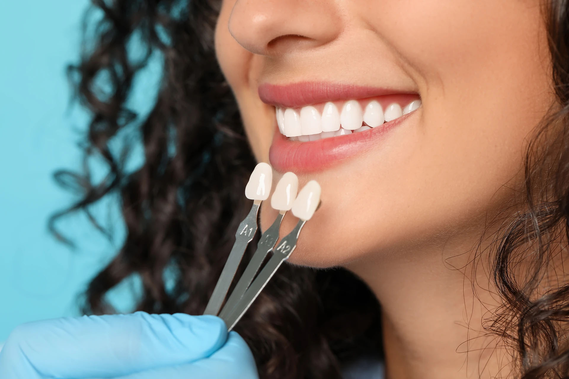 Dentist holding veneer shade samples beside a woman's bright smile against a blue background