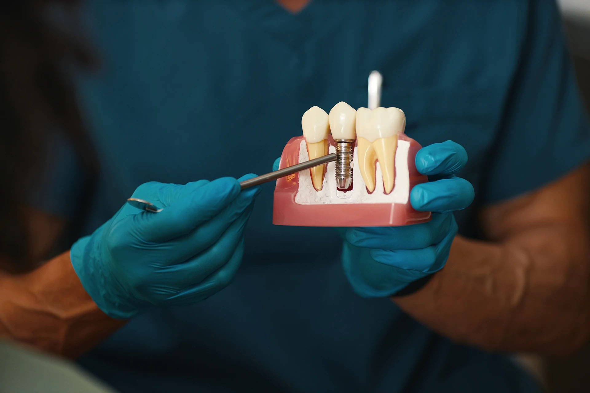 Blue-gloved hands pointing a probe at a dental implant cross-section model
