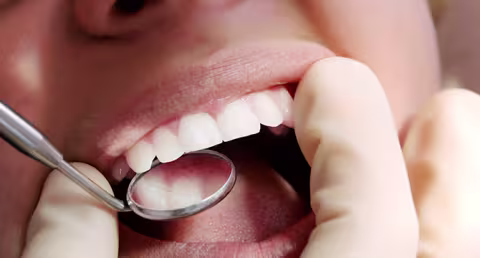 Mouth mirror exam, close-up